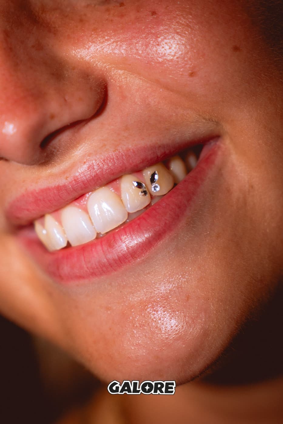 Tooth Gems Vlissingen ✦